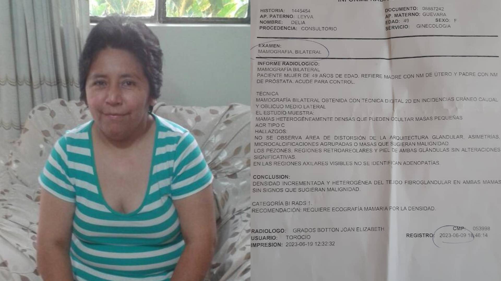 Paciente de 49 años consiguió realizarse examen médico en el hospital María Auxiliadora 