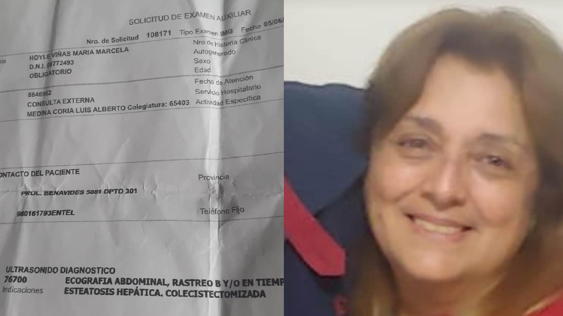 Santiago de Surco: mujer de 67 años espera cita en el área de medicina general desde hace casi tres meses