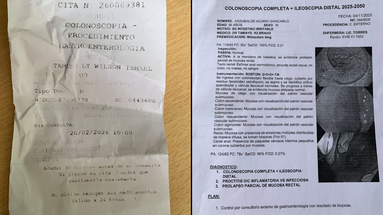 Se malogró equipo para realizar colonoscopia del Hospital San Rosa en Pueblo Libre